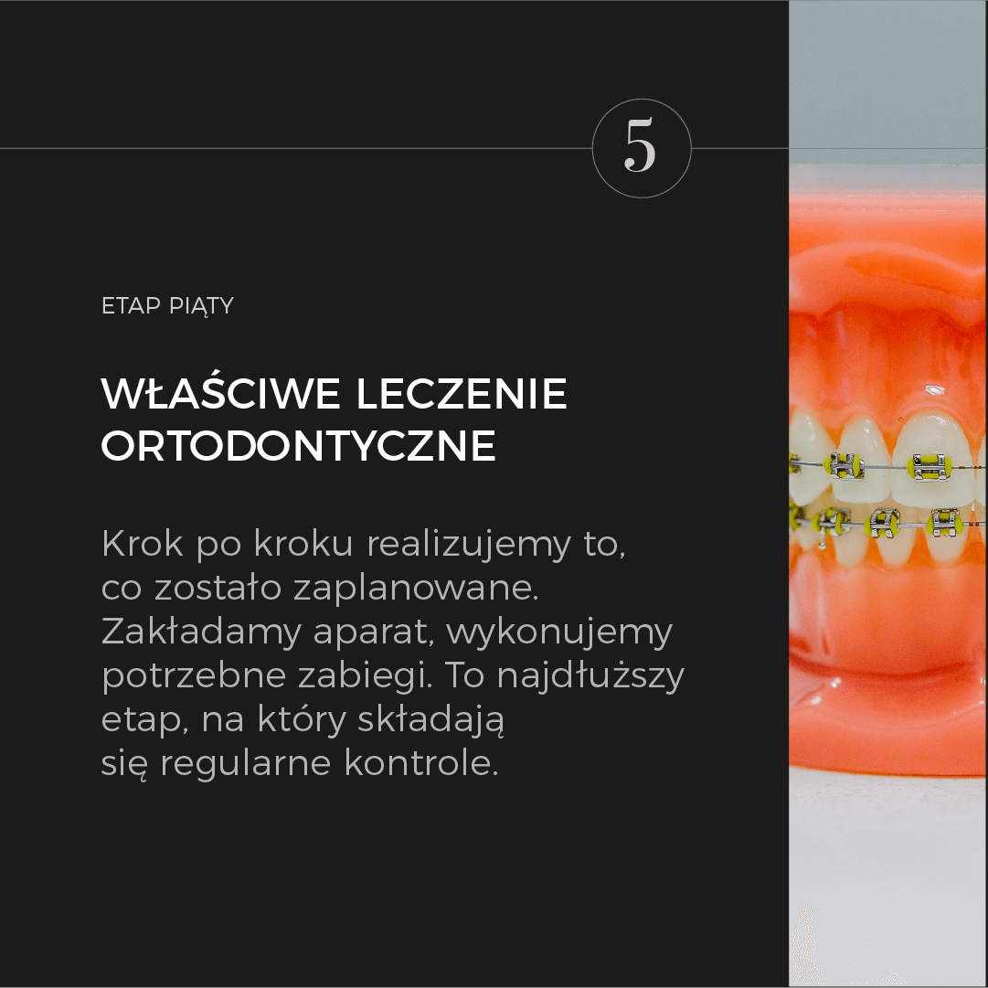 Leczenie_ortodontyczne_07